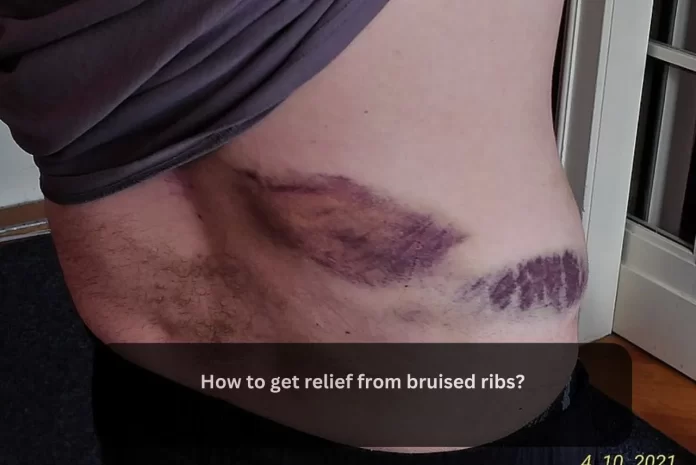bruised ribs