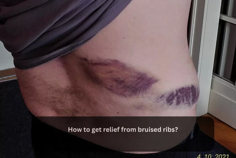 How to get relief from bruised ribs?